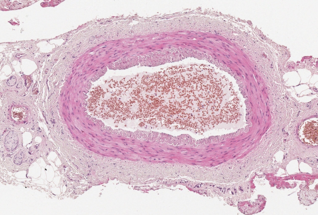 normal-temporal-artery-histology-gca-histology